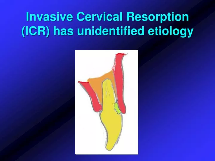 invasive cervical resorption icr has unidentified etiology