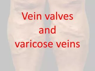 Vein valves and varicose veins
