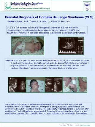 Prenatal Diagnosis of Cornelia de Lange Syndrome (CLS)