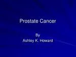 Prostate Cancer - slide 1