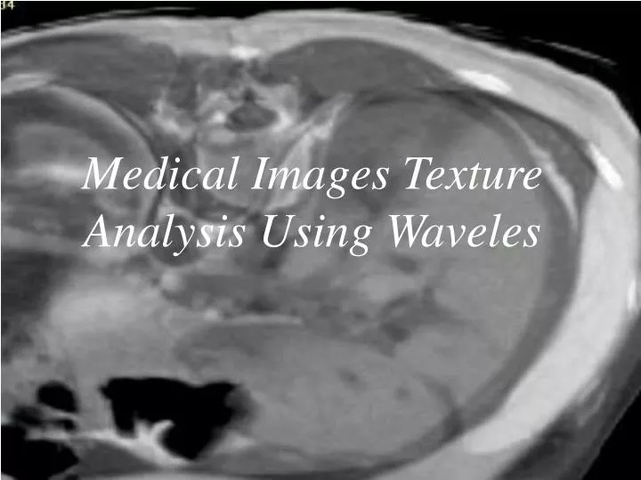 medical images texture analysis using waveles