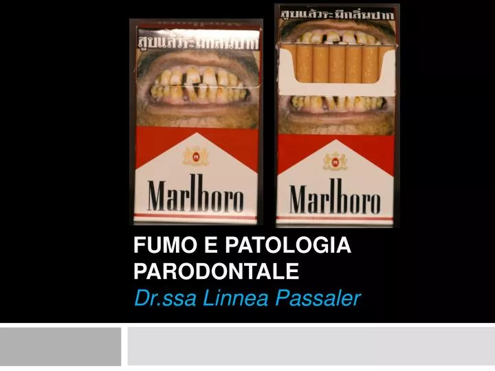 fumo e patologia parodontale dr ssa linnea passaler
