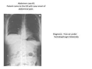 Diagnosis: Free air under hemidiaphragm bilaterally