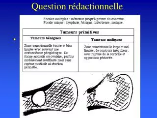 question r dactionnelle
