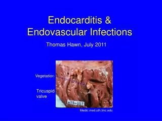 Endocarditis &amp; Endovascular Infections