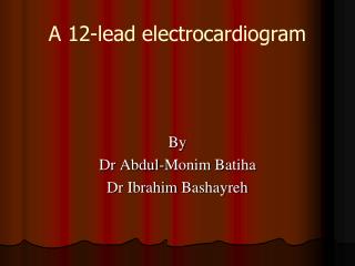 A 12-lead electrocardiogram