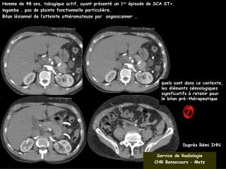 Homme de 48 ans, tabagique actif, ayant présenté un 1 er épisode de SCA ST+. ingambe , pas de plainte fonctionnelle par