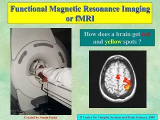 Functional Magnetic Resonance Imaging or fMRI