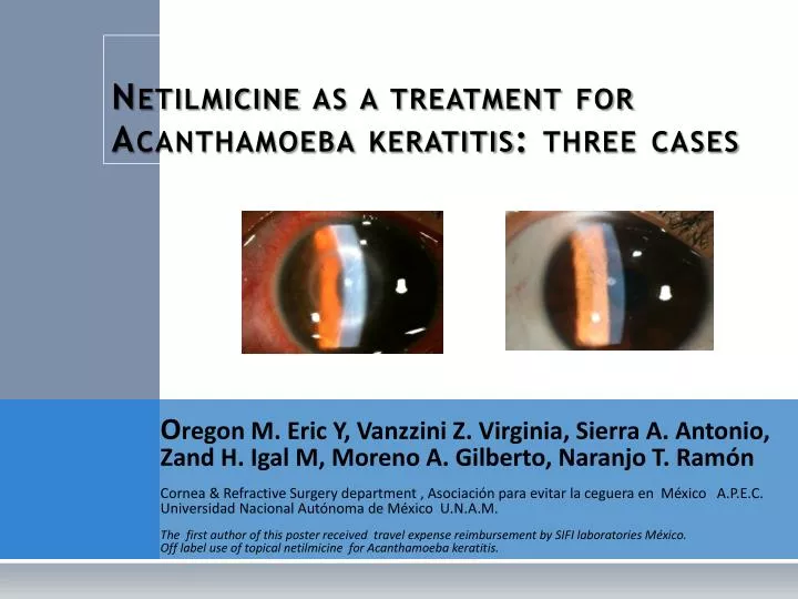 netilmicine as a treatment for acanthamoeba keratitis three cases
