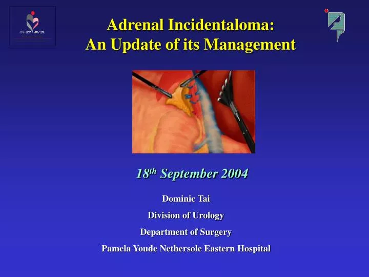 adrenal incidentaloma an update of its management