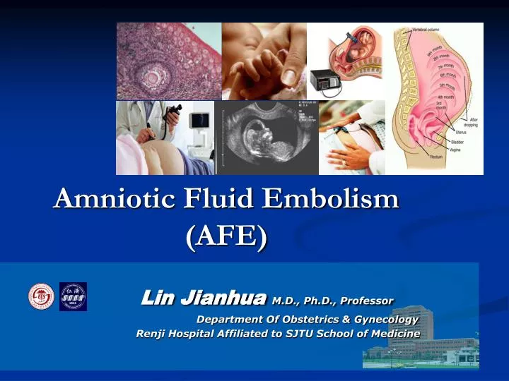 amniotic fluid embolism afe