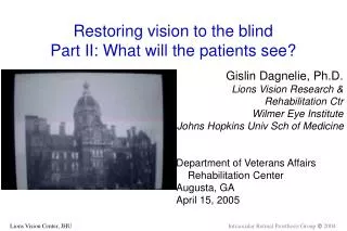 Restoring vision to the blind Part II: What will the patients see?