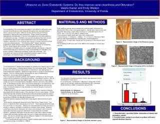 Ultrasonic vs. Sonic Endodontic Systems: Do they improve canal cleanliness and Obturation? Valerie Kanter and Emily Weld
