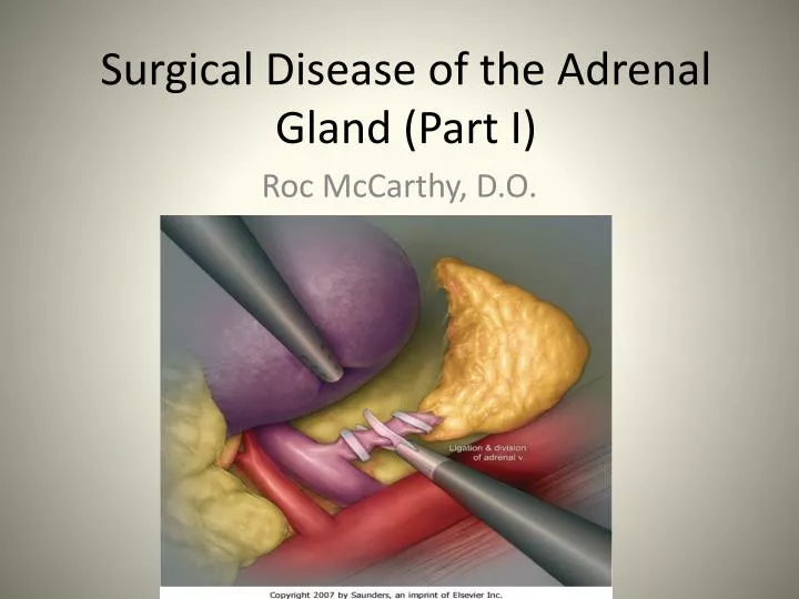 surgical disease of the adrenal gland part i