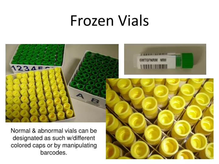 frozen vials