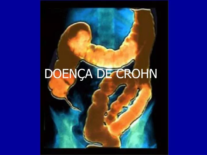 doen a de crohn