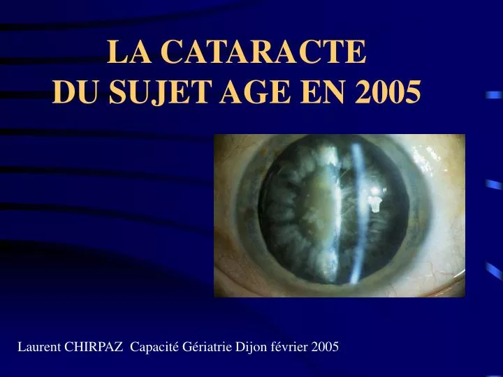 la cataracte du sujet age en 2005