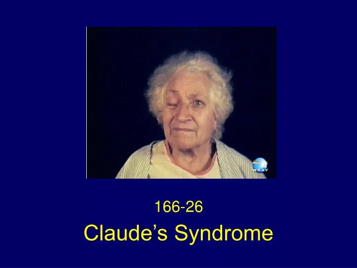 claude s syndrome