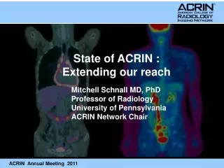 Mitchell Schnall MD, PhD Professor of Radiology University of Pennsylvania ACRIN Network Chair