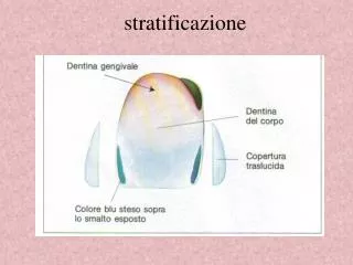 stratificazione