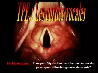 TPE : Les cordes vocales