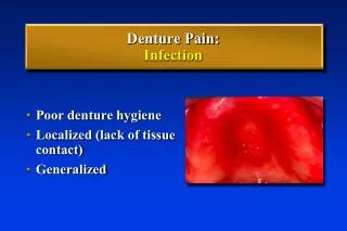 Denture Pain: Infection