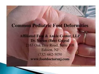 Common Pediatric Foot Deformities Affiliated Foot &amp; Ankle Center, LLP Dr. Varun (Ben) Gujral 2163 Oak Tree Road, Su