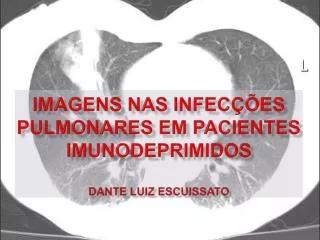 Imagens nas infecções pulmonares em pacientes imunodepRimidos Dante Luiz Escuissato