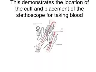 This demonstrates the location of the cuff and placement of the stethoscope for taking blood pressure