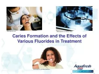 Caries Formation and the Effects of Various Fluorides in Treatment