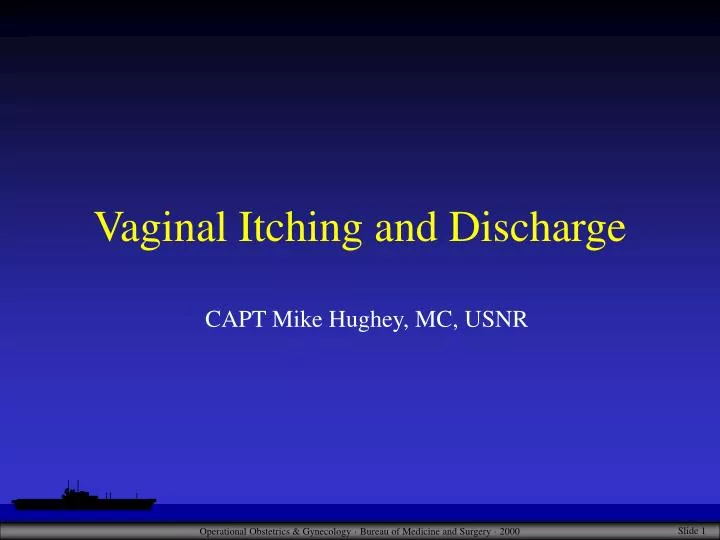 vaginal itching and discharge