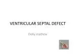 VENTRICULAR SEPTAL DEFECT - slide 1