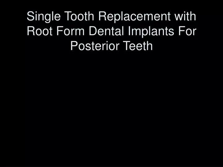 single tooth replacement with root form dental implants for posterior teeth