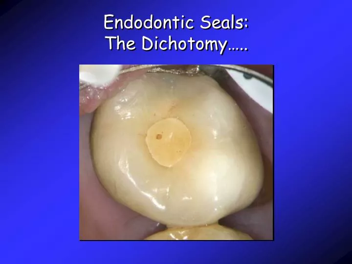 endodontic seals the dichotomy