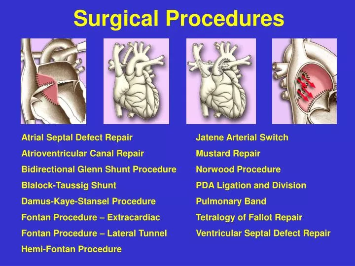 surgical procedures