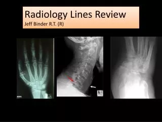 Radiology Lines Review Jeff Binder R.T. (R)