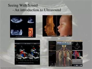 Background Image: http://krohnert.org/gallery/d/6382-2/ultrasound-20-weeks.jpg