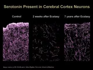 Image courtesy of Dr. GA Ricaurte, Johns Hopkins University School of Medicine