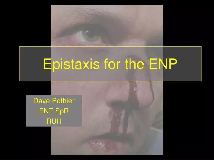epistaxis for the enp