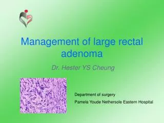 Management of large rectal adenoma