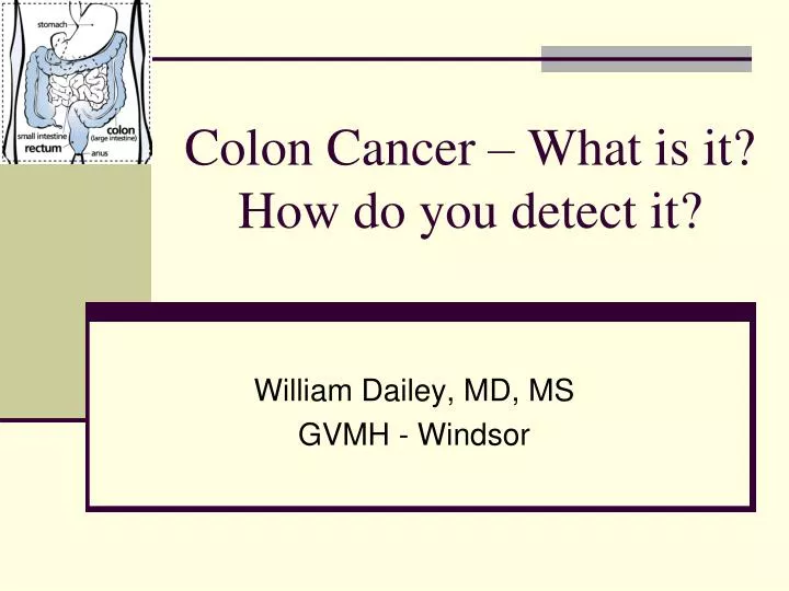colon cancer what is it how do you detect it