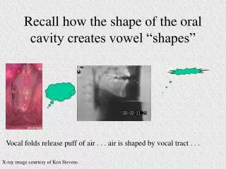 Recall how the shape of the oral cavity creates vowel “shapes”