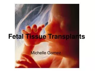 Fetal Tissue Transplants