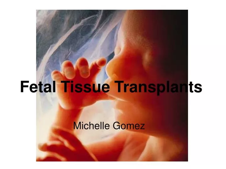 fetal tissue transplants