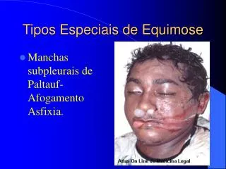tipos especiais de equimose
