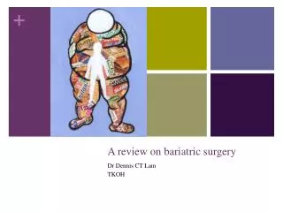 A review on bariatric surgery