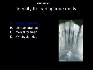 Identify the radiopaque entity