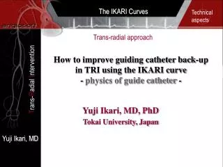 How to improve guiding catheter back-up in TRI using the IKARI curve - physics of guide catheter -