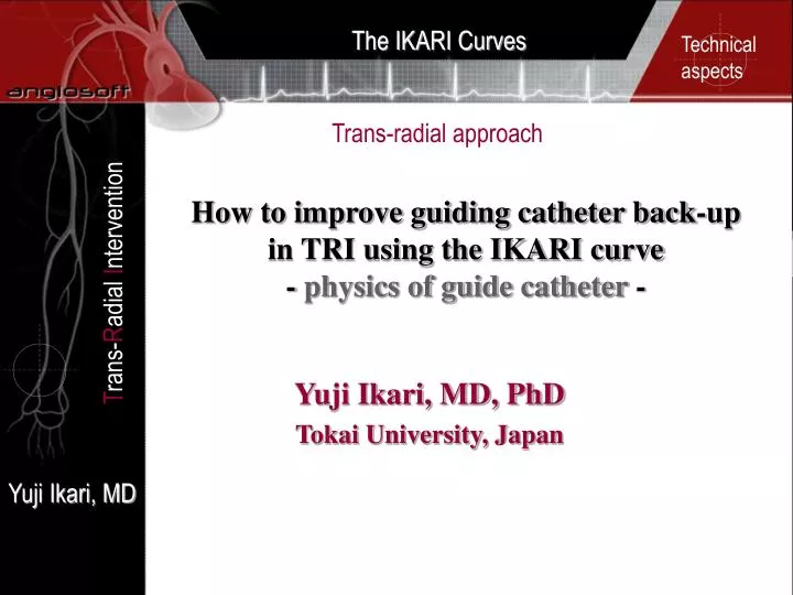 how to improve guiding catheter back up in tri using the ikari curve physics of guide catheter