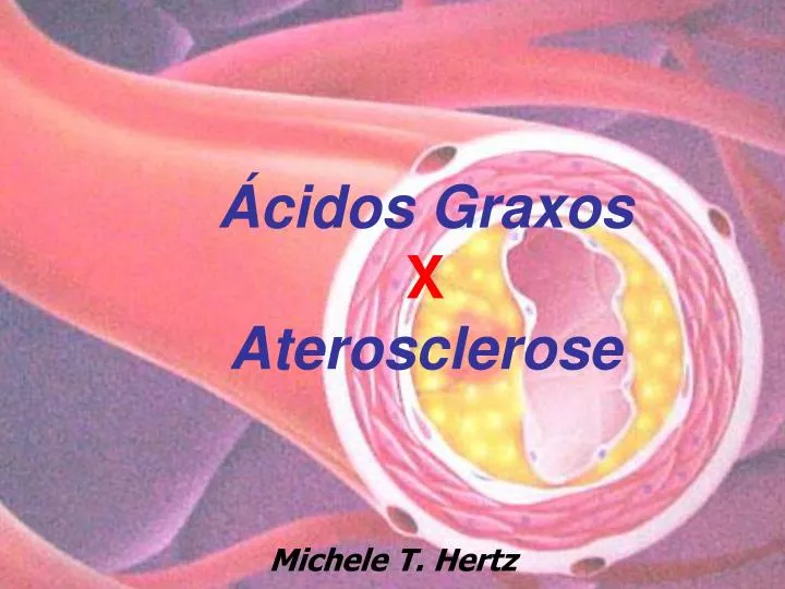 cidos graxos x aterosclerose